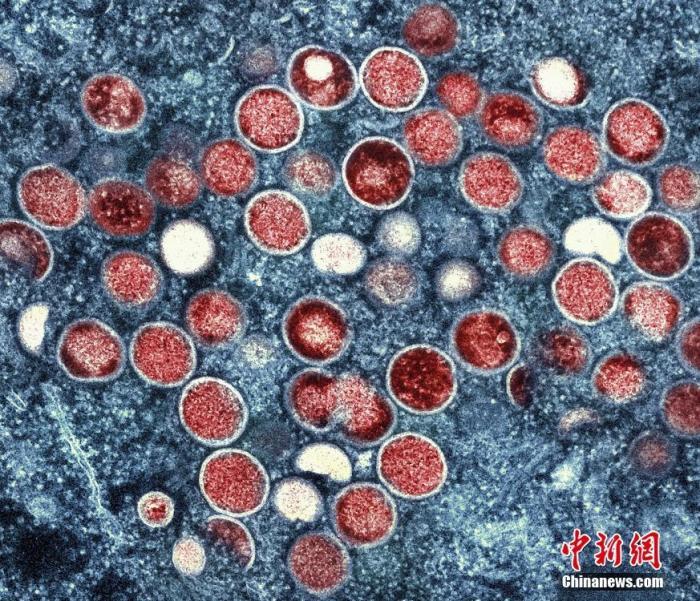 百家樂:世衛:已批準首款猴痘疫苗,將促進在非洲推廣使用
